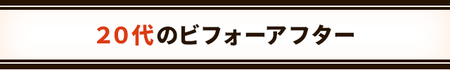 20代のビフォーアフター