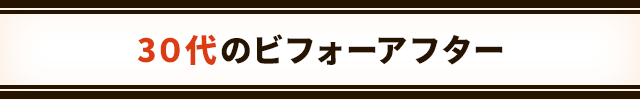30代のビフォーアフター