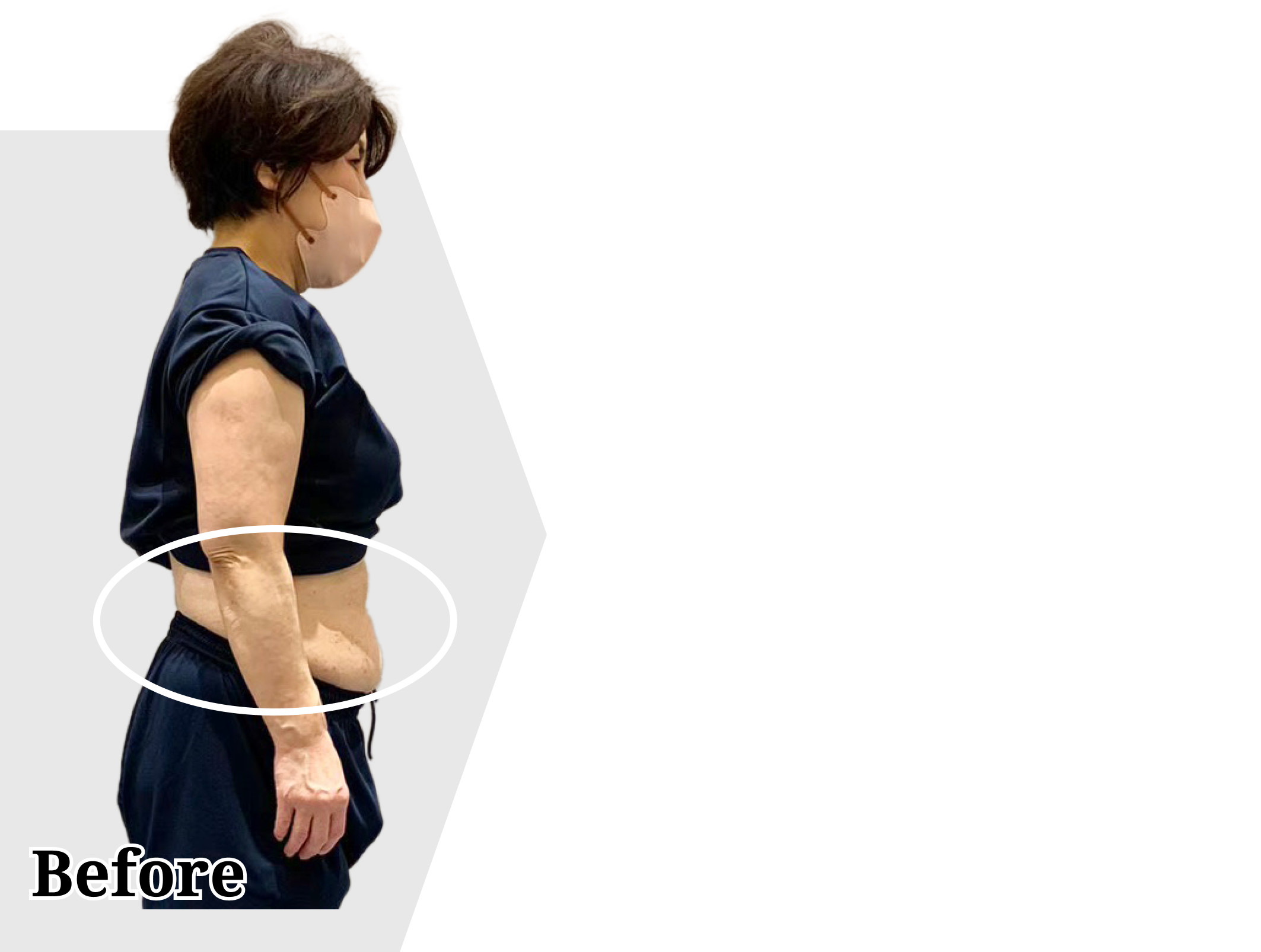 広島のパーソナルジムNEXTBODYのダイエット結果6