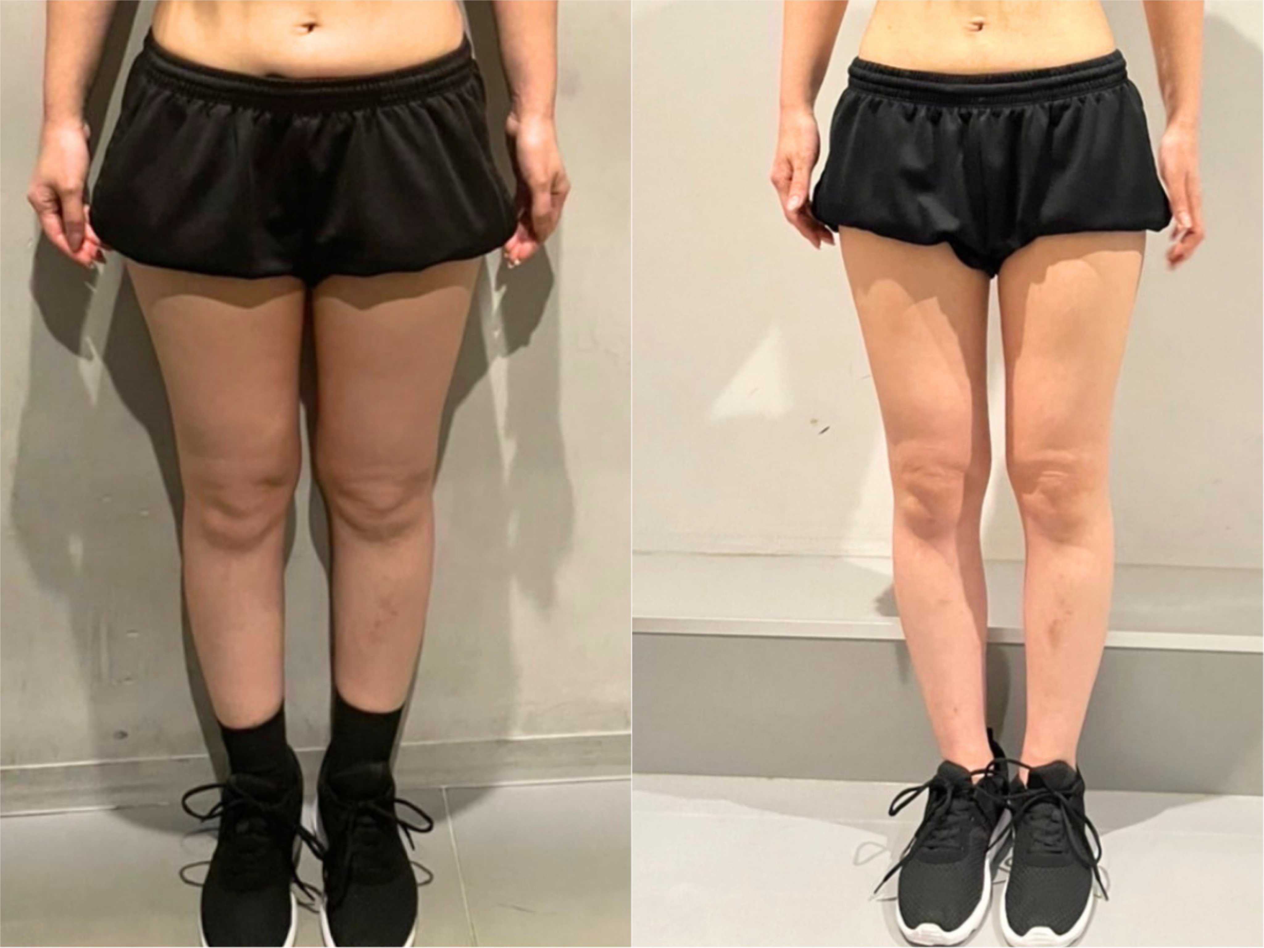 ダイエット実績25