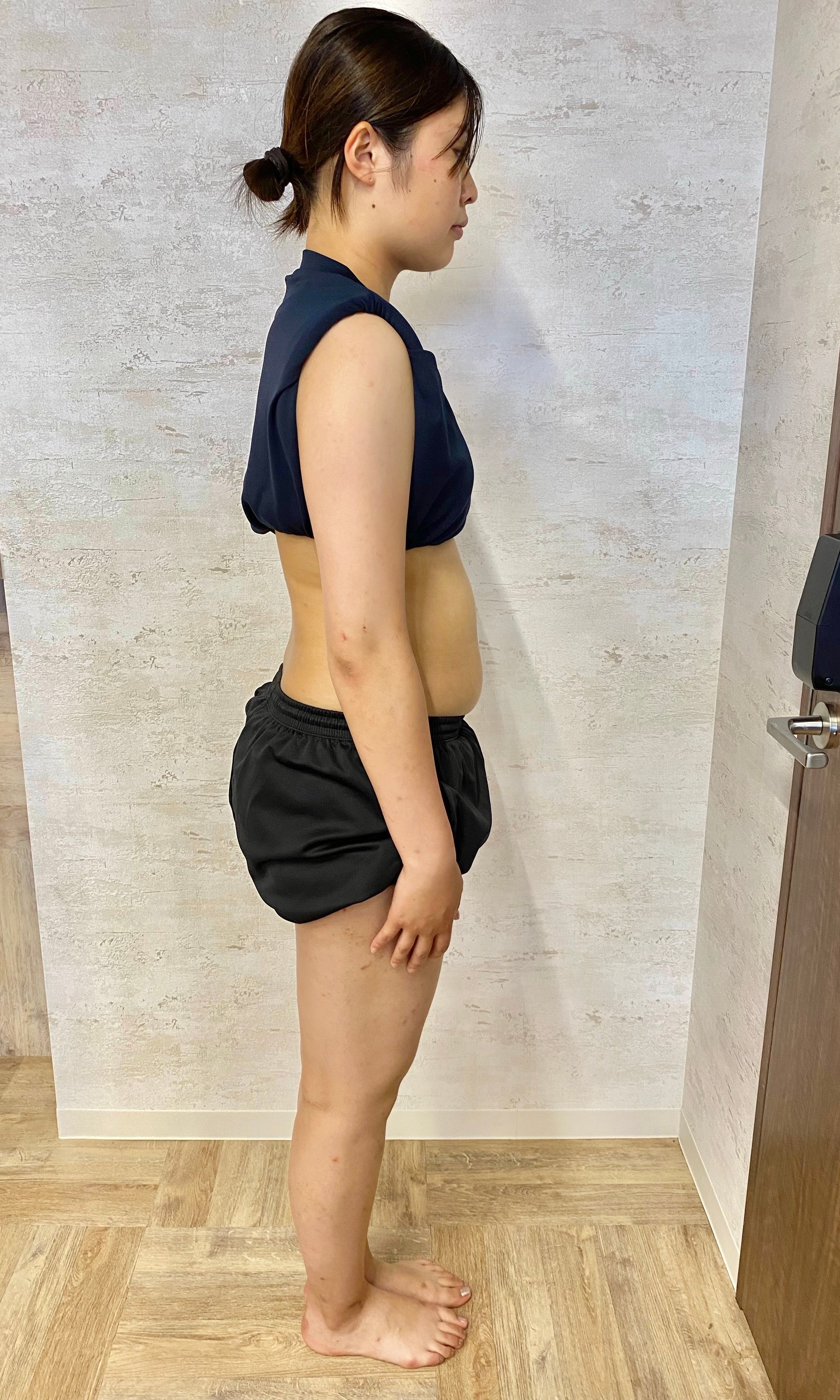 S様の全身を横から撮影した写真