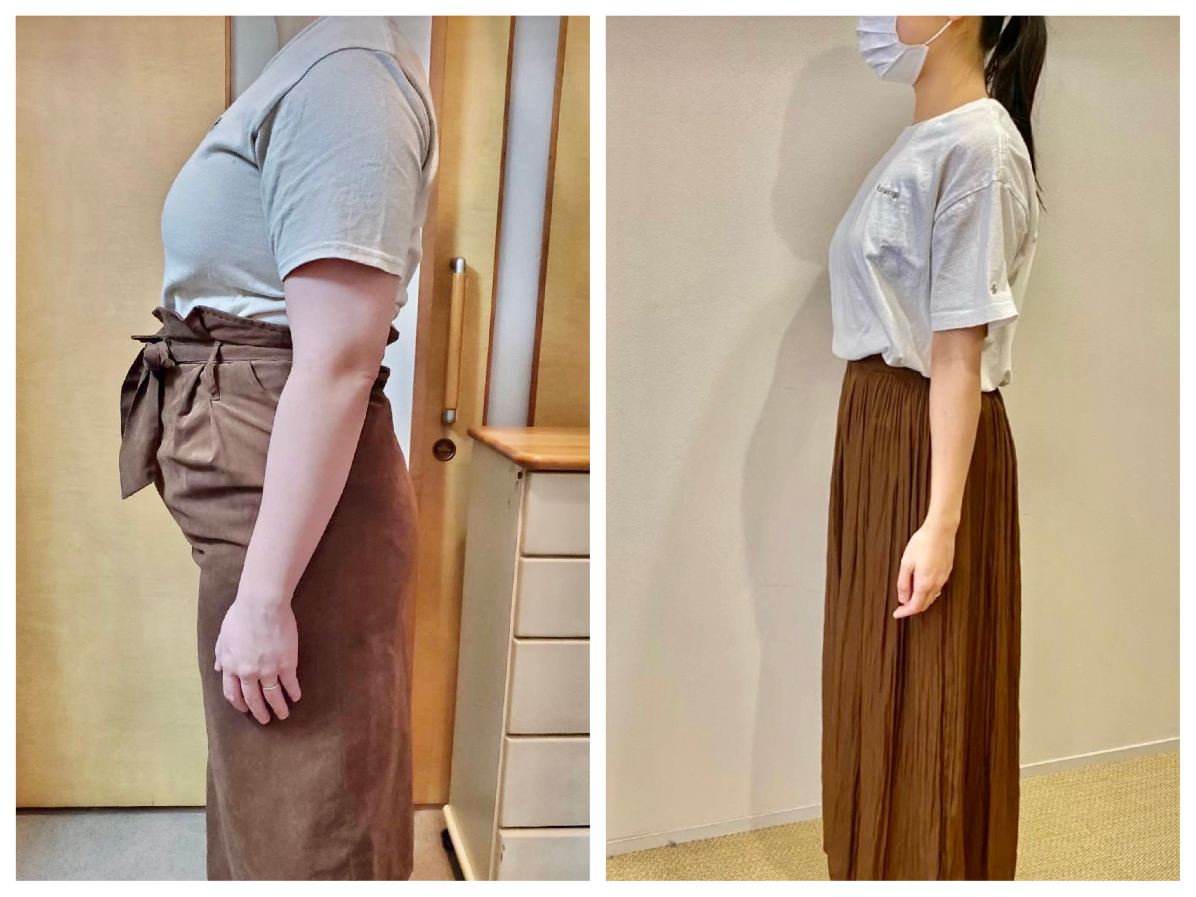 I様のダイエット開始前と3ヶ月半後の横姿を比較した写真