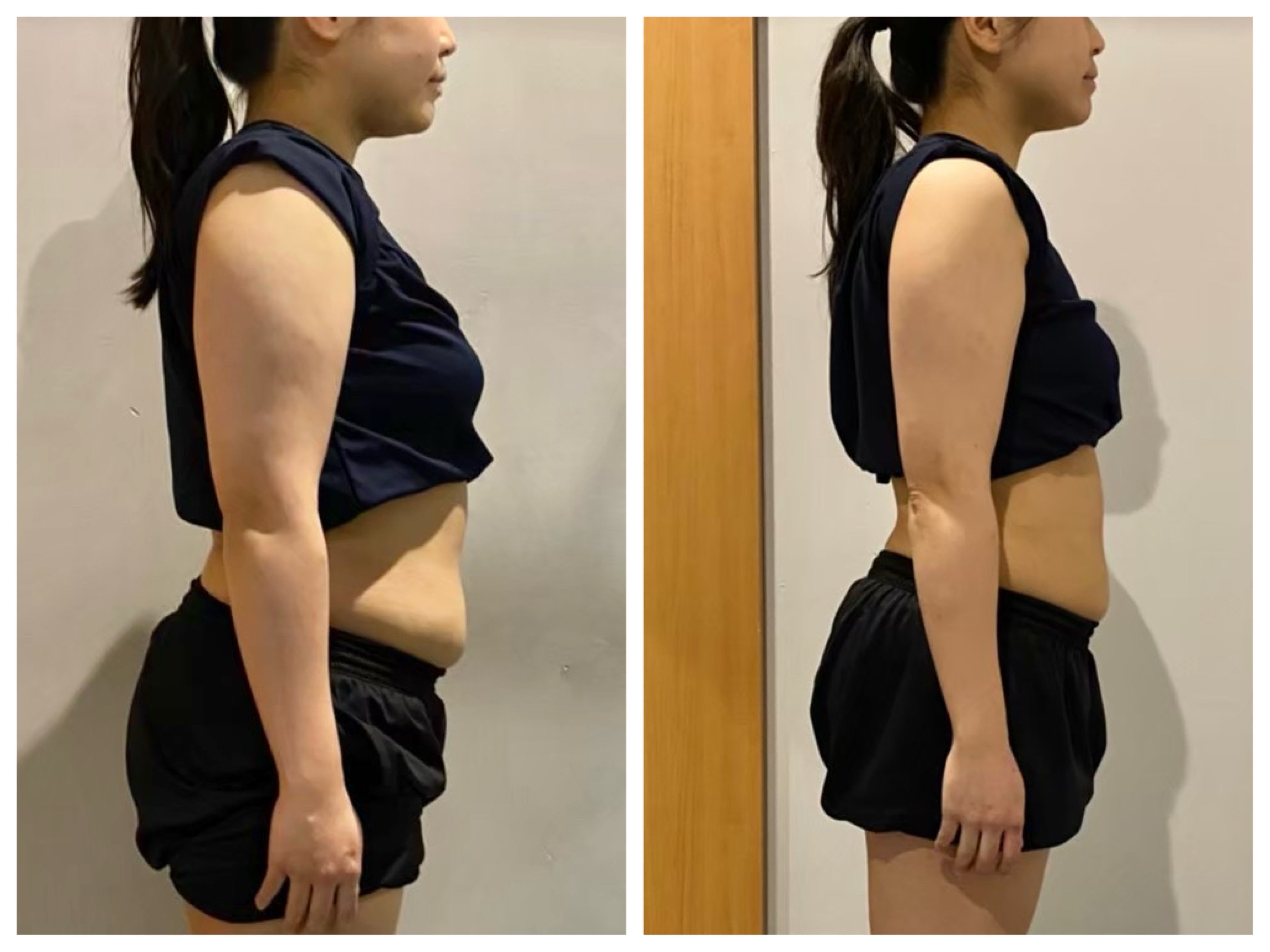 I様のダイエット開始前と1ヶ月後の横姿を比較した写真